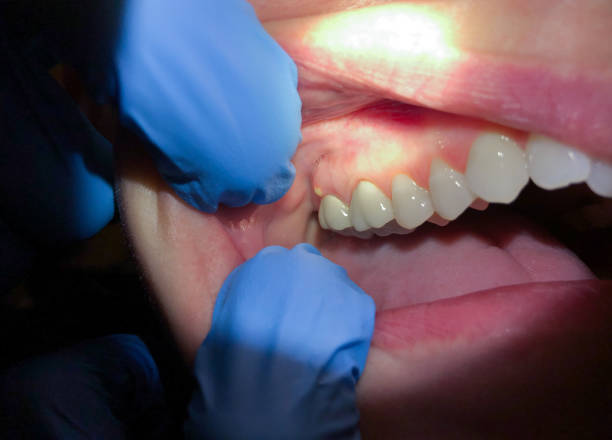 Best Emergency Gum Pain Relief  in Mountain Road, VA
