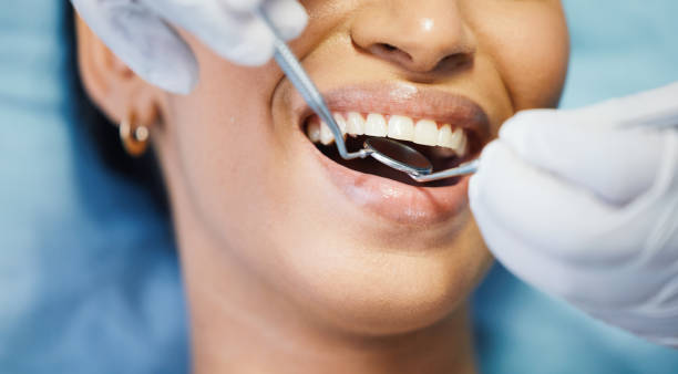 Best Knocked-Out Tooth Emergency  in Mountain Road, VA
