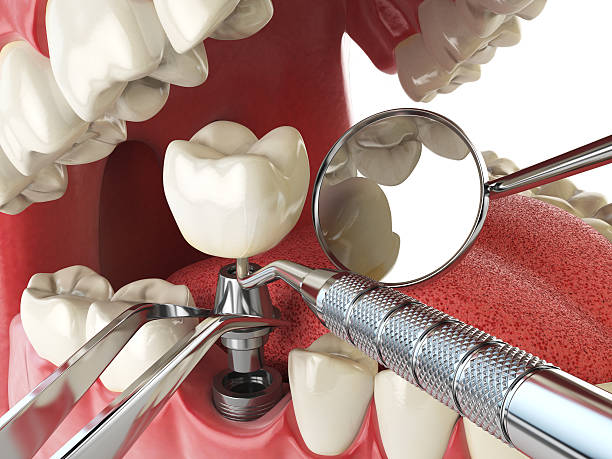 Best Broken Tooth Emergency  in Mountain Road, VA